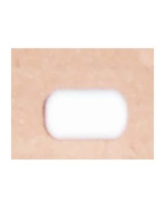 THERMO 50087924 KOMET 15 round ?9xL15 mm 5 pcs.
